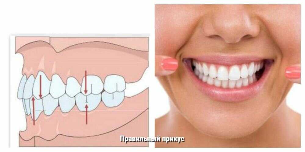 Тест: какие раны вам мешают быть собой
